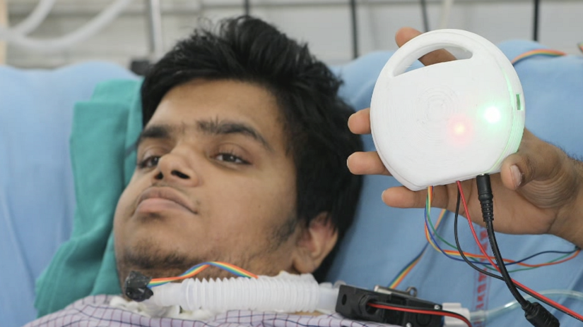 the world's smallest and cheapest ventilator can help millions of patients the world's smallest and cheapest ventilator can help millions of patients